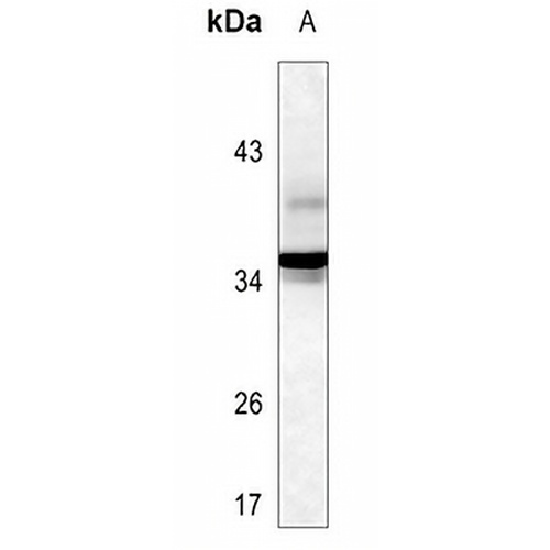 TorsinA Mouse Monoclonal Antibody(C3514)