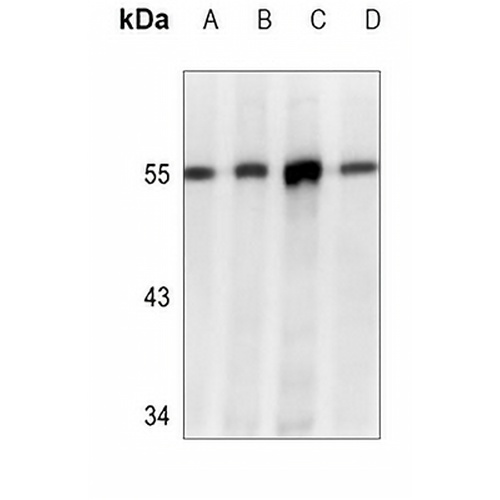 CHK1 Mouse Monoclonal Antibody(C3515)