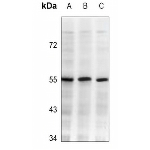 IKK beta Mouse Monoclonal Antibody(C3516)
