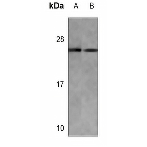 RAB7L1 Mouse Monoclonal Antibody(C3517)