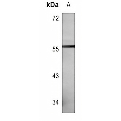 CYP27B1 Mouse Monoclonal Antibody(C3521)