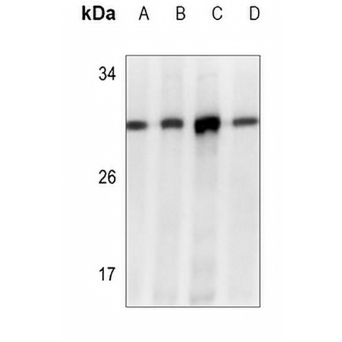 ATG7 Mouse Monoclonal Antibody(C3544)