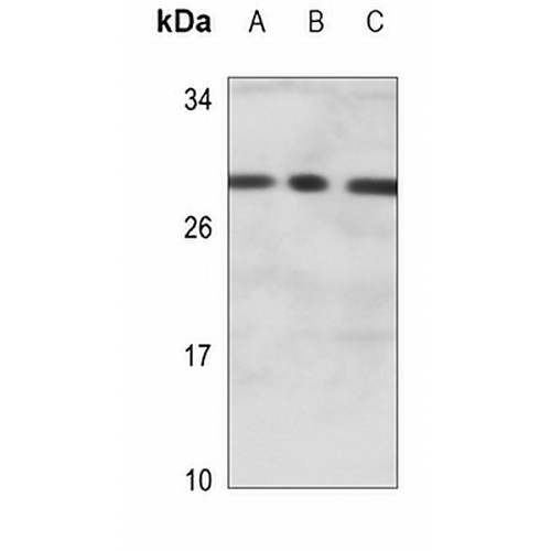SNAI1 Mouse Monoclonal Antibody(C3547)