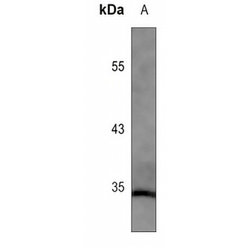 MBD3 Mouse Monoclonal Antibody(C3548)