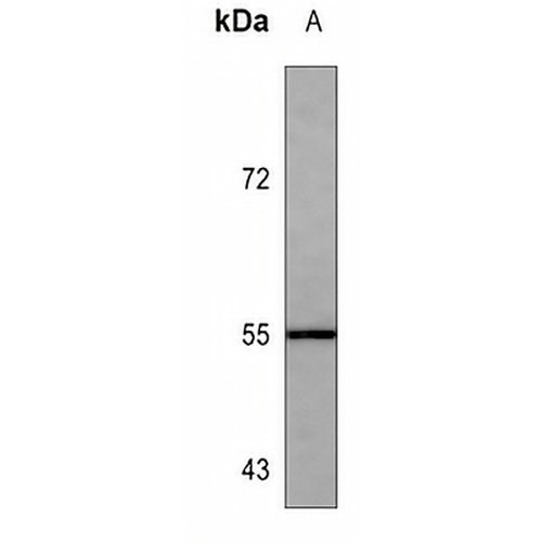 ALDH1A1 Mouse Monoclonal Antibody(C3550)