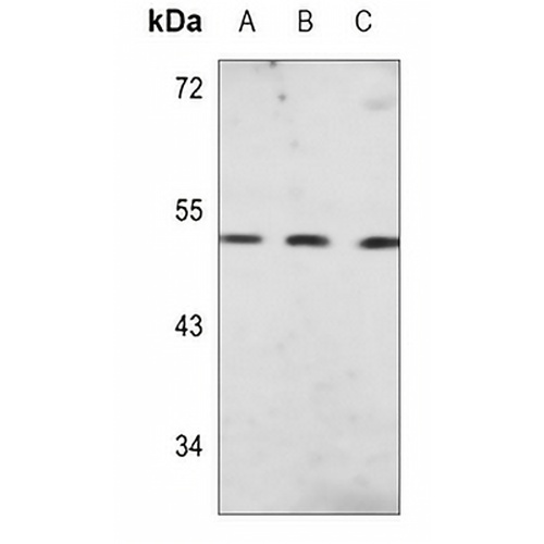 PAH Mouse Monoclonal Antibody(C3551)