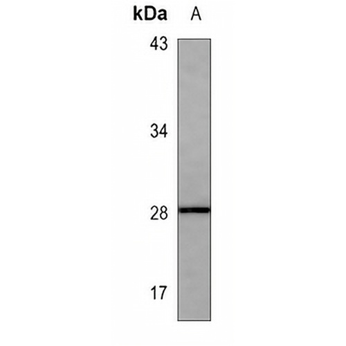 HPRT Mouse Monoclonal Antibody(C3552)