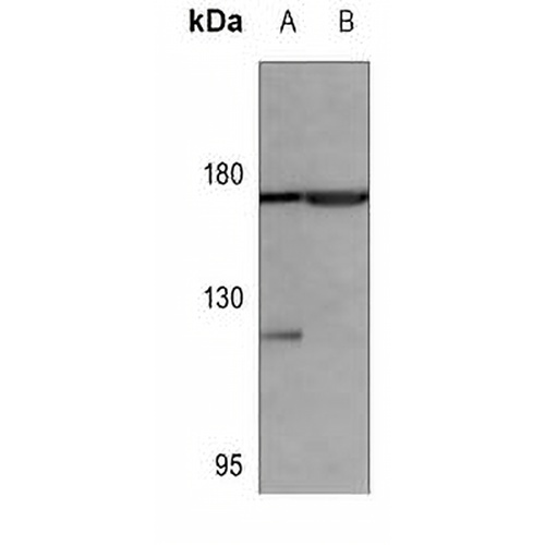 EGFR Mouse Monoclonal Antibody(C3553)
