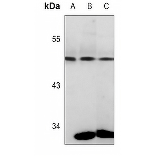 PGK1 Mouse Monoclonal Antibody(C3554)