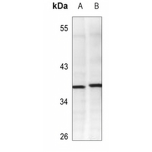 Adenosine Deaminase Mouse Monoclonal Antibody(C3556)