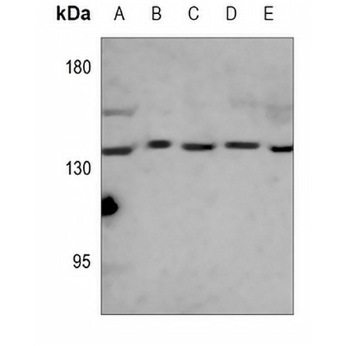 Complement C3 Mouse Monoclonal Antibody(C3558)