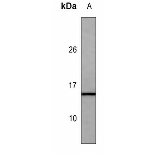 Cystatin C Mouse Monoclonal Antibody(C3559)