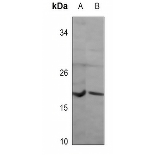 NRAS Mouse Monoclonal Antibody(C3561)