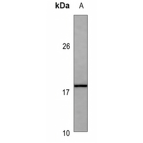 ANP Mouse Monoclonal Antibody(C3562)