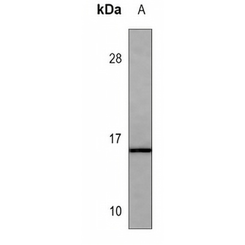 Calcitonin Mouse Monoclonal Antibody(C3564)