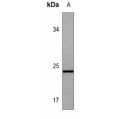 IFN beta Mouse Monoclonal Antibody(C3568)