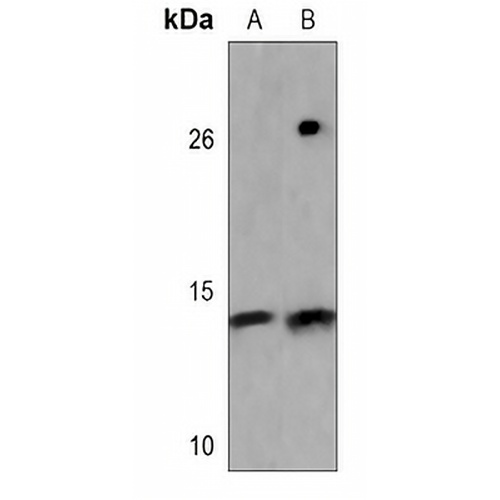 Myoglobin Mouse Monoclonal Antibody(C3574)