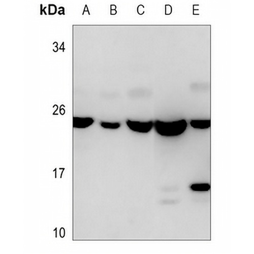 Alpha-crystallin B Mouse Monoclonal Antibody(C3575)