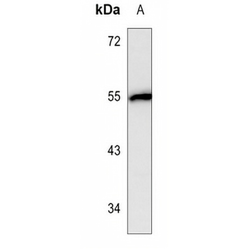 Fibrinogen gamma Mouse Monoclonal Antibody(C3578)