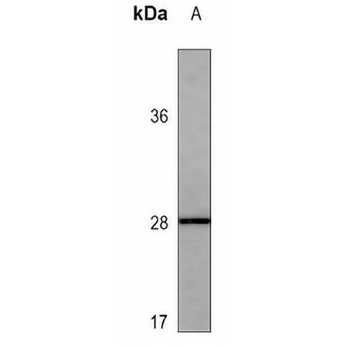 APCS Mouse Monoclonal Antibody(C3581)