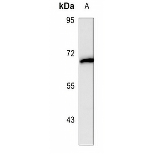 Alpha-fetoglobulin Mouse Monoclonal Antibody(C3583)