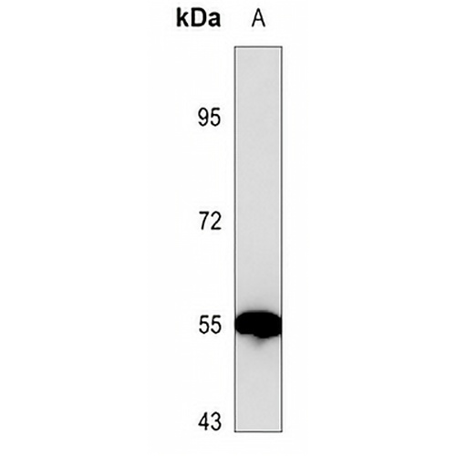 Estrogen Receptor alpha Mouse Monoclonal Antibody(C3586)
