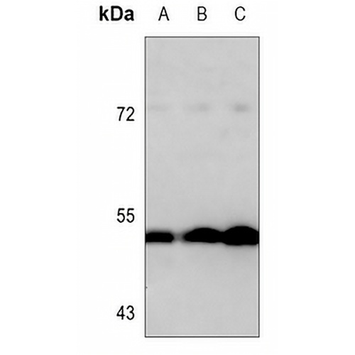 MMP1 Mouse Monoclonal Antibody(C3587)
