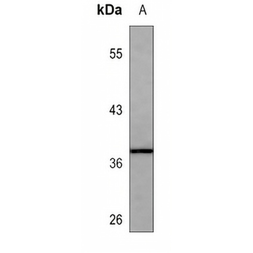 HLA-B Mouse Monoclonal Antibody(C3588)