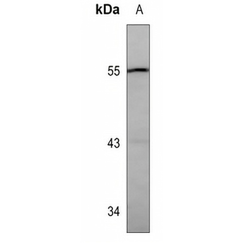 Catalase Mouse Monoclonal Antibody(C3590)