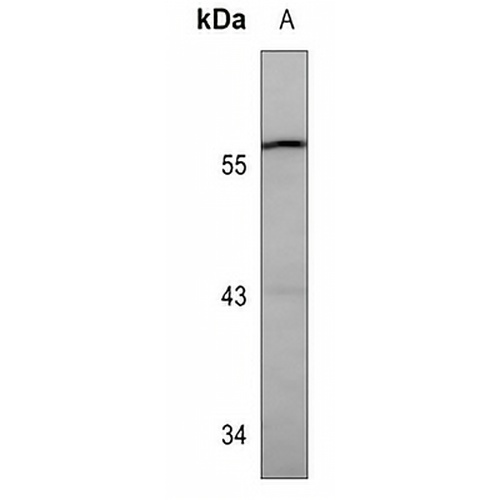 GBA Mouse Monoclonal Antibody(C3591)