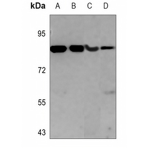 Glucocorticoid Receptor Mouse Monoclonal Antibody(C3593)