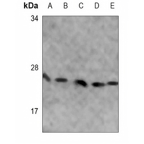 SOD2 Mouse Monoclonal Antibody(C3594)