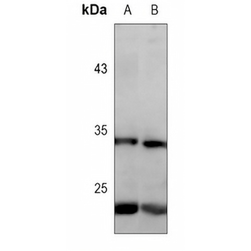 CD74 Mouse Monoclonal Antibody(C3595)