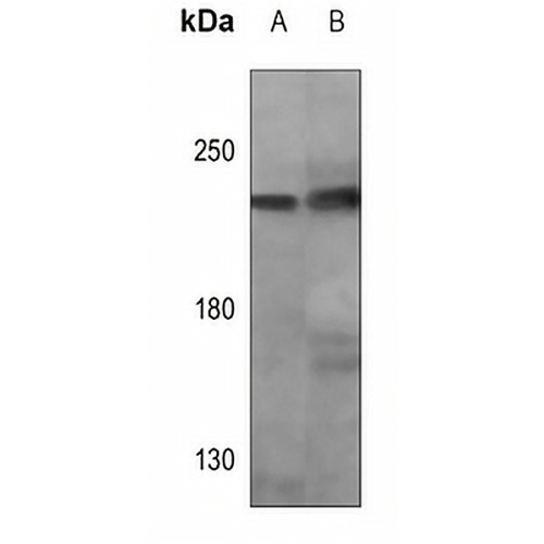 HER2 Mouse Monoclonal Antibody(C3599)