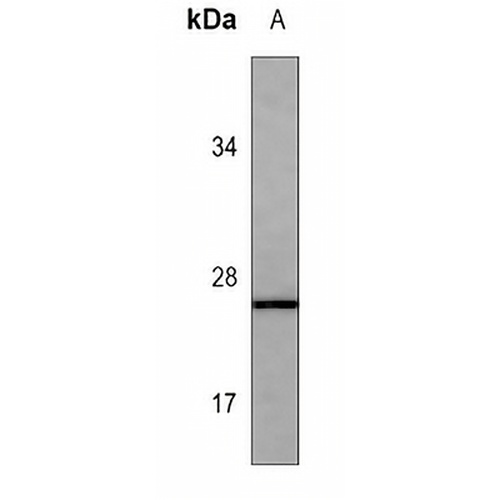 Calpain reg Mouse Monoclonal Antibody(C3600)
