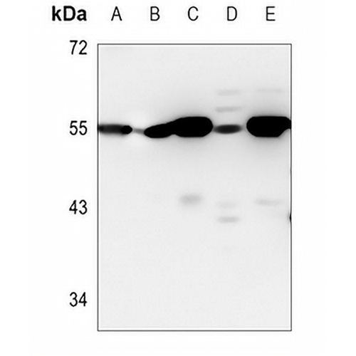 p53 Mouse Monoclonal Antibody(C3601)