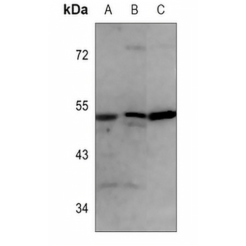 ALDH2 Mouse Monoclonal Antibody(C3603)