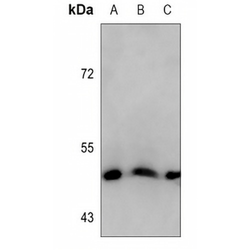 Cytokeratin 18 Mouse Monoclonal Antibody(C3612)