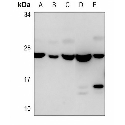 EIF4E Mouse Monoclonal Antibody(C3617)