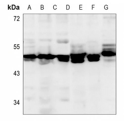 Alpha-enolase Mouse Monoclonal Antibody(C3618)