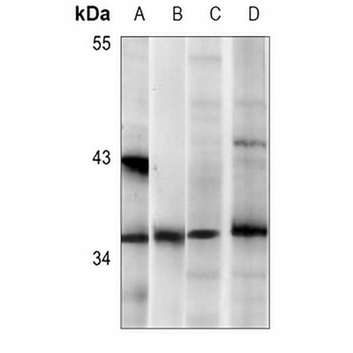 Nucleophosmin Mouse Monoclonal Antibody(C3619)