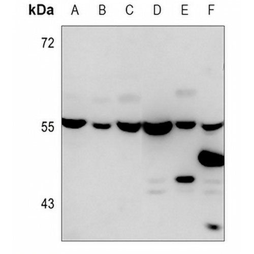 Beta5-tubulin Mouse Monoclonal Antibody(C3627)