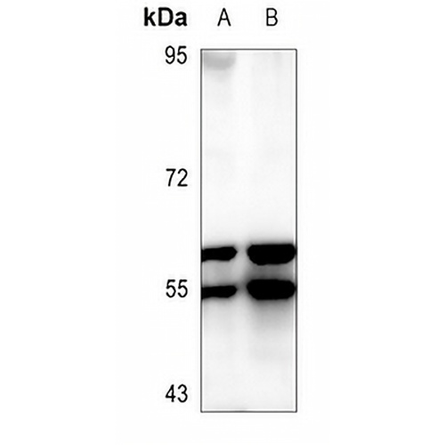 LYN Mouse Monoclonal Antibody(C3631)