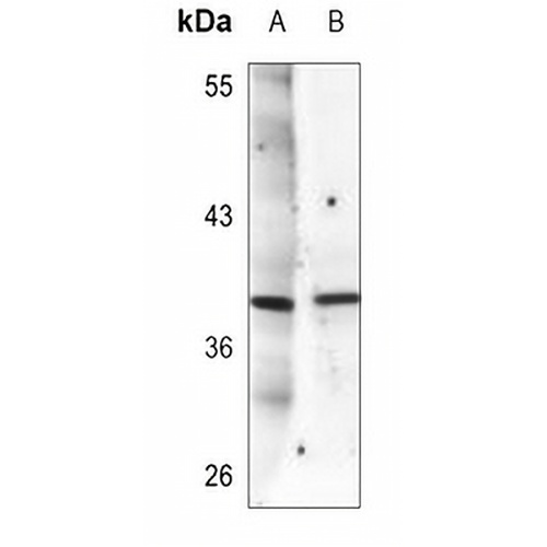 Synaptophysin Mouse Monoclonal Antibody(C3639)