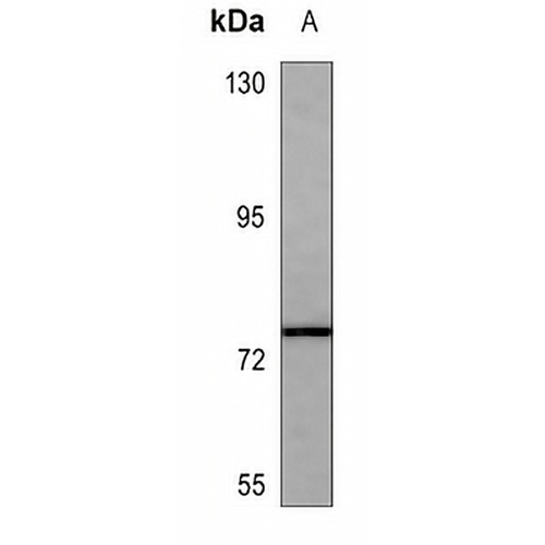 MMP2 Mouse Monoclonal Antibody(C3640)