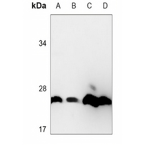GSTA1 Mouse Monoclonal Antibody(C3641)