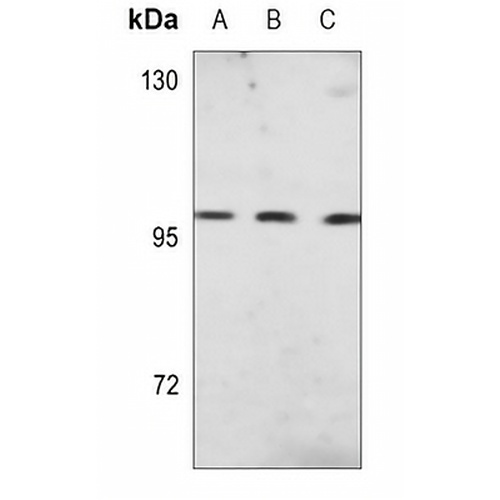 CD10 Mouse Monoclonal Antibody(C3642)