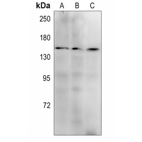 c-Met Mouse Monoclonal Antibody(C3644)