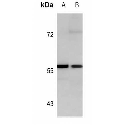 HCK Mouse Monoclonal Antibody(C3646)
