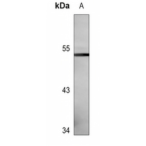 Cytochrome P450 3A4 Mouse Monoclonal Antibody(C3649)